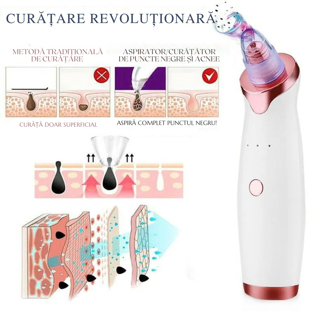 Extractor de acnee™ – Curățare Eficientă și Fără Durere