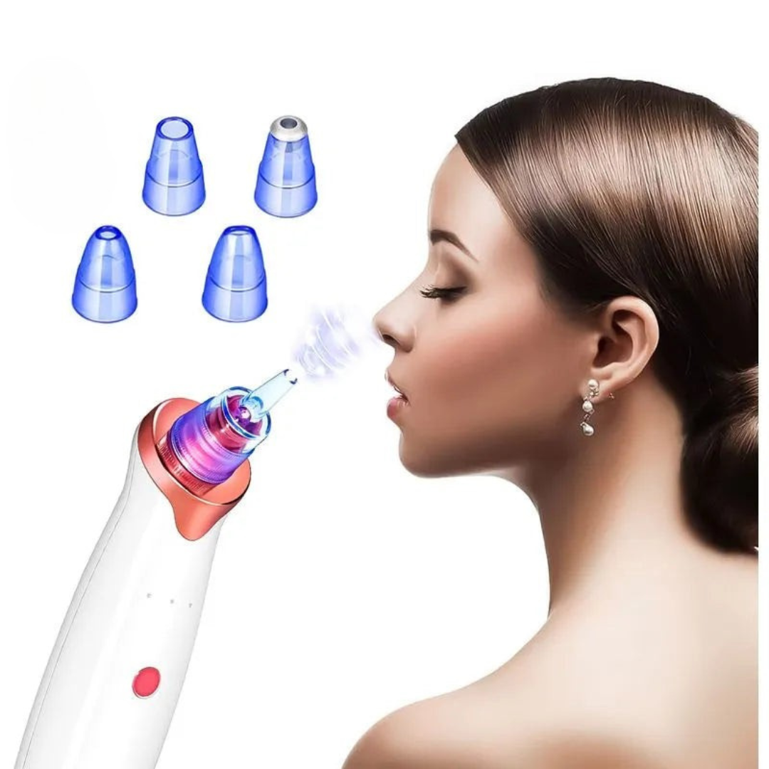 Extractor de acnee™ – Curățare Eficientă și Fără Durere