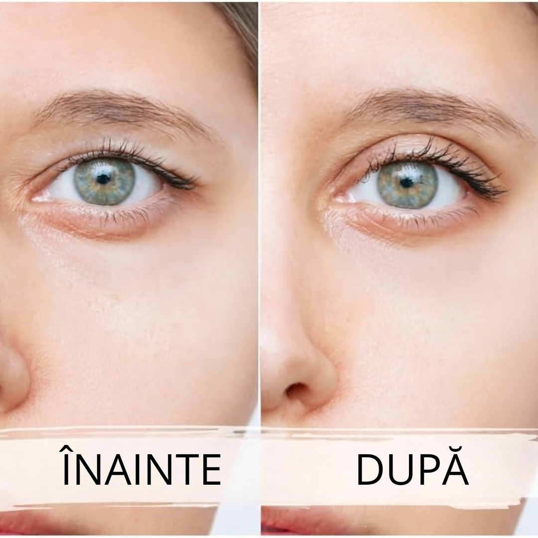Eyelid PushUp™ 🤩 Privire Instantanee ✨ 120 Perechi! 😱