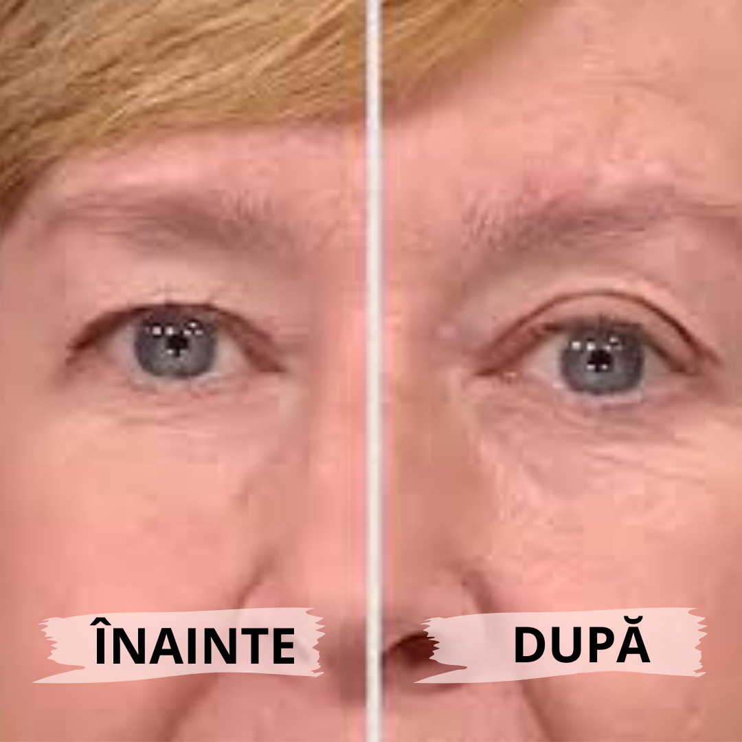 Eyelid PushUp™ 🤩 Privire Instantanee ✨ 120 Perechi! 😱