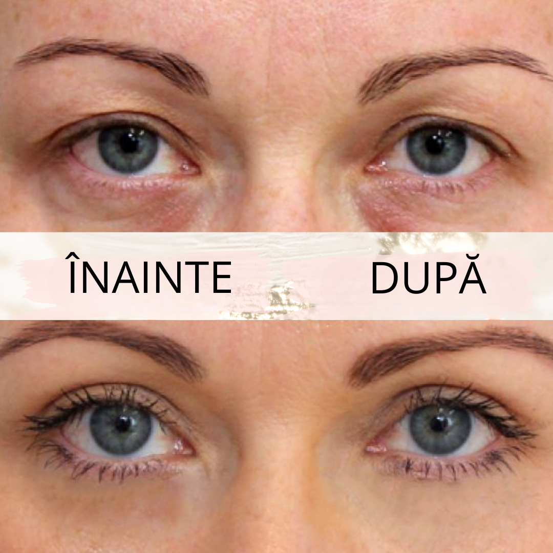 Eyelid PushUp™ 🤩 Privire Instantanee ✨ 120 Perechi! 😱