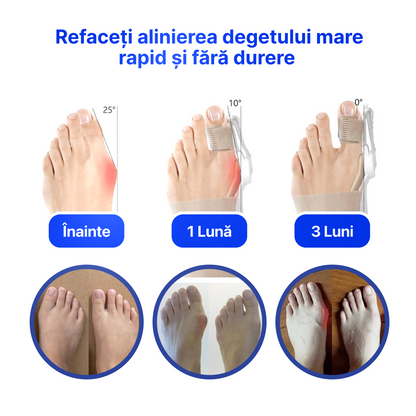 Orteză Corectoare pentru Degetul Mare – 1+1 CADOU 🎁