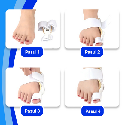 Orteză Corectoare pentru Degetul Mare – 1+1 CADOU 🎁