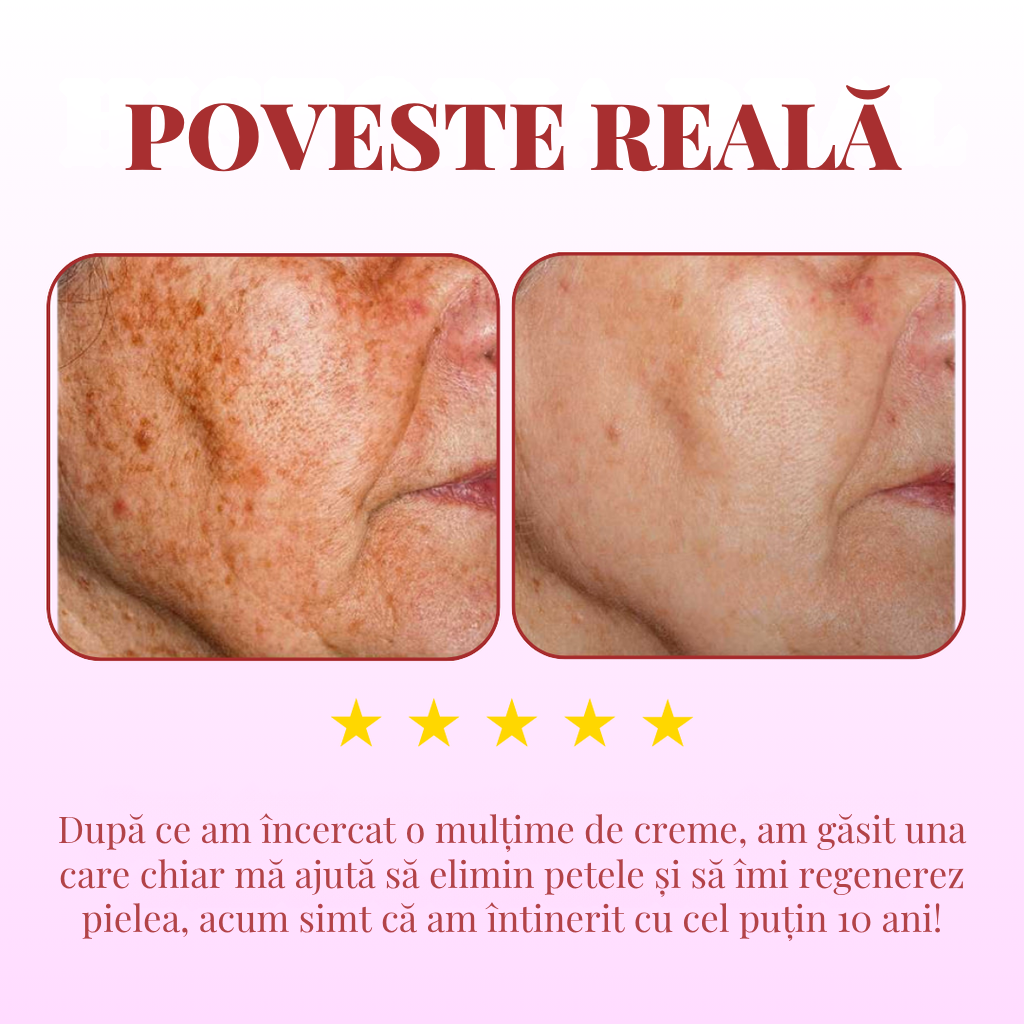 DragoCream™ | Aceeași piele, dar cu 10 ani mai tânără! | 2x2 doar astăzi