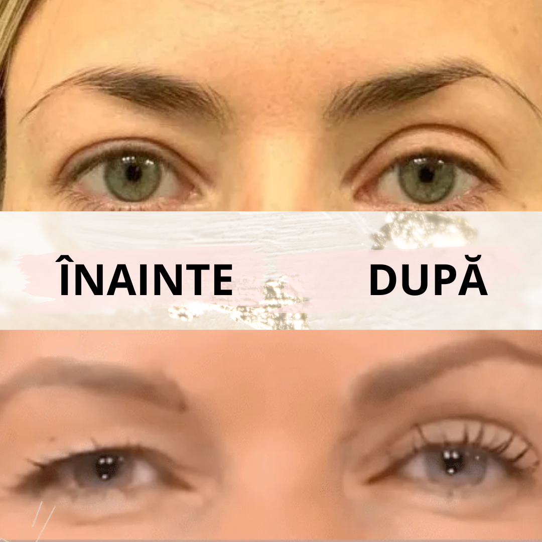 Eyelid PushUp™ 🤩 Privire Instantanee ✨ 120 Perechi! 😱