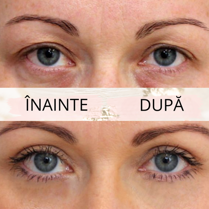 Eyelid PushUp™ 🤩 Privire Instantanee ✨ 120 Perechi! 😱