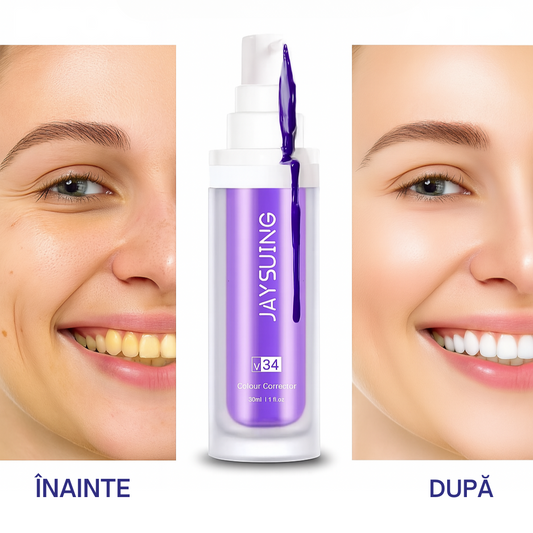 GlumiWhite™ – V34 Albire – [OFERTĂ VALABILĂ DOAR ASTĂZI]