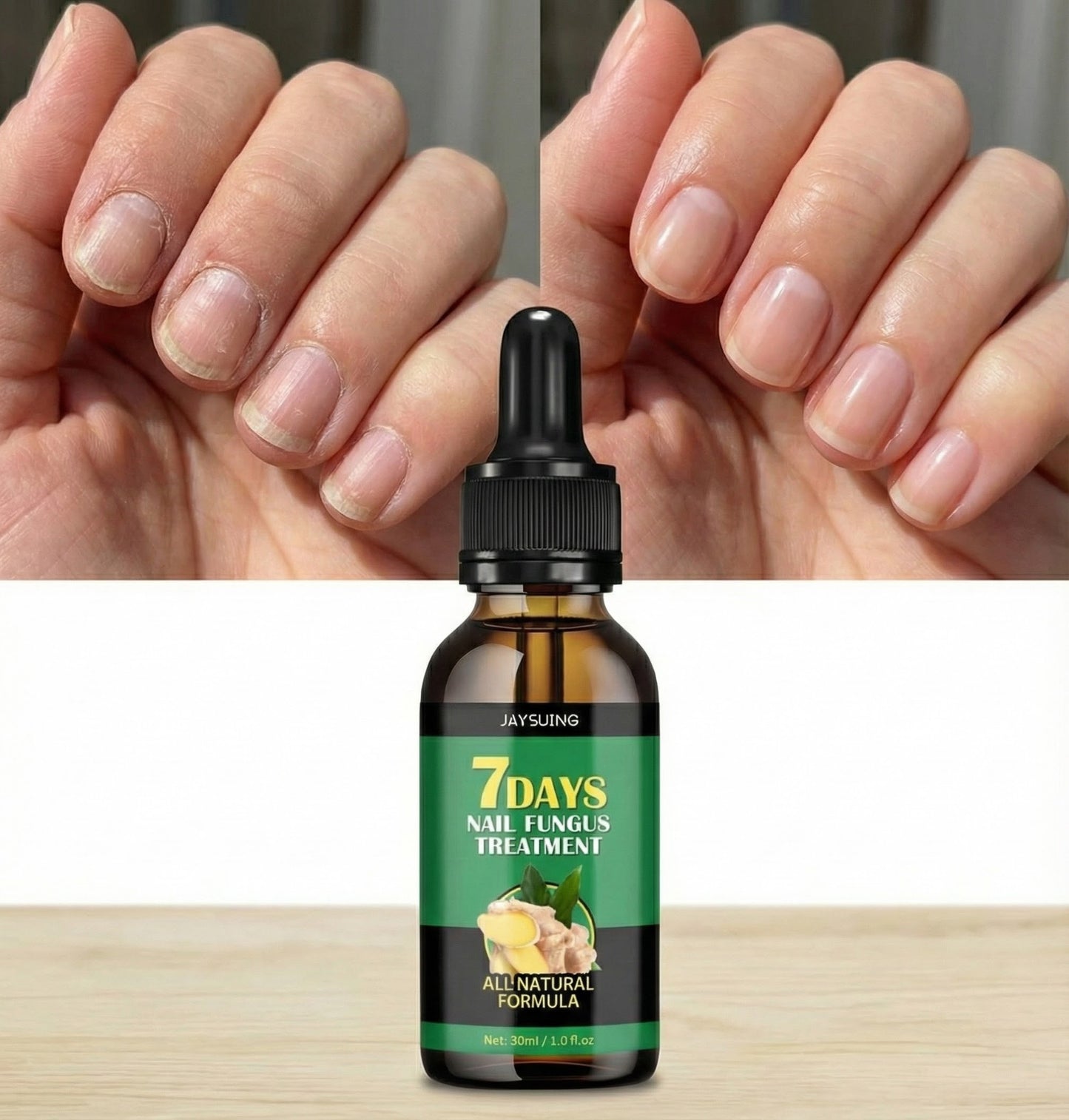 NailCare™ - Ulei Natural Pentru Îngrijirea Unghiilor