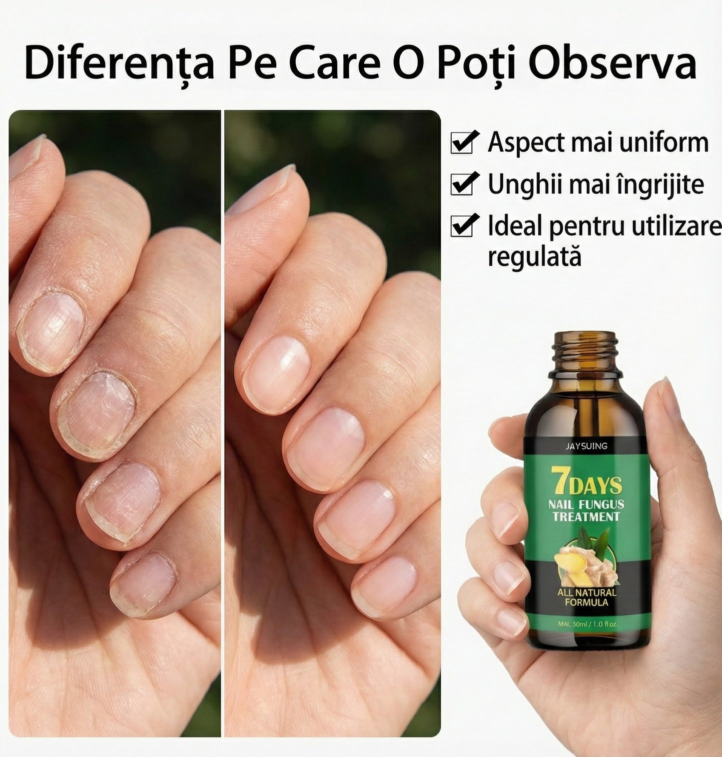 NailCare™ - Ulei Natural Pentru Îngrijirea Unghiilor