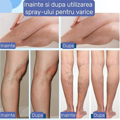 VenoRelief™ - alinare imediată pentru picioare