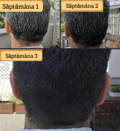 ClackCover™ - Săpunul Pentru Părul Gri, Natural Si Eficient