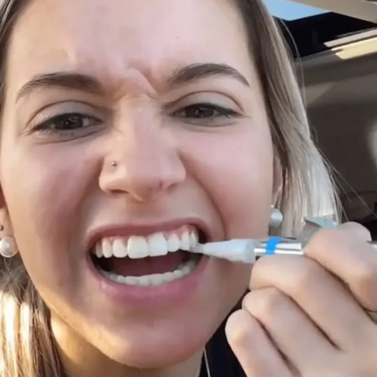 Creion de albire profesională – Zâmbet alb și strălucitor în câteva zile